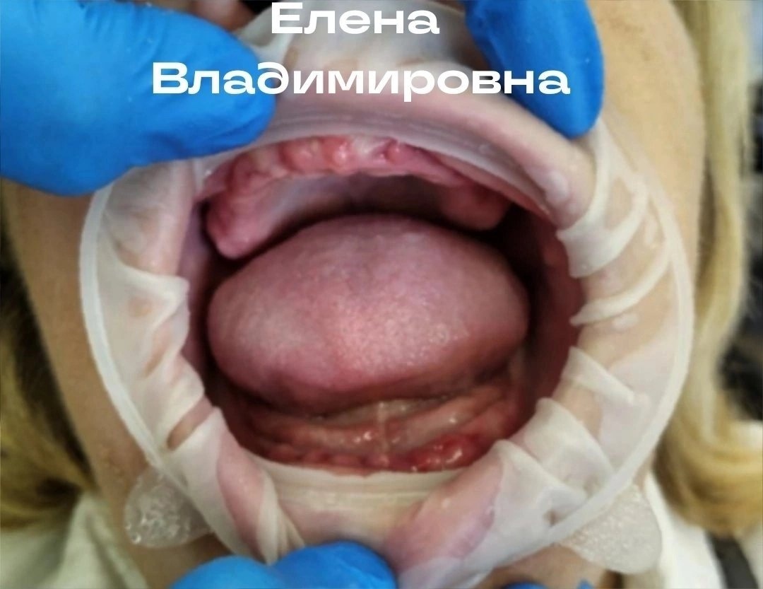 До