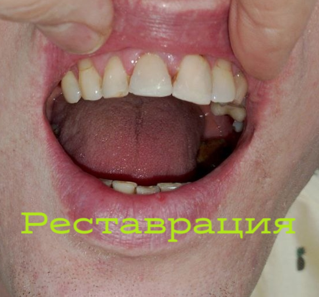 После