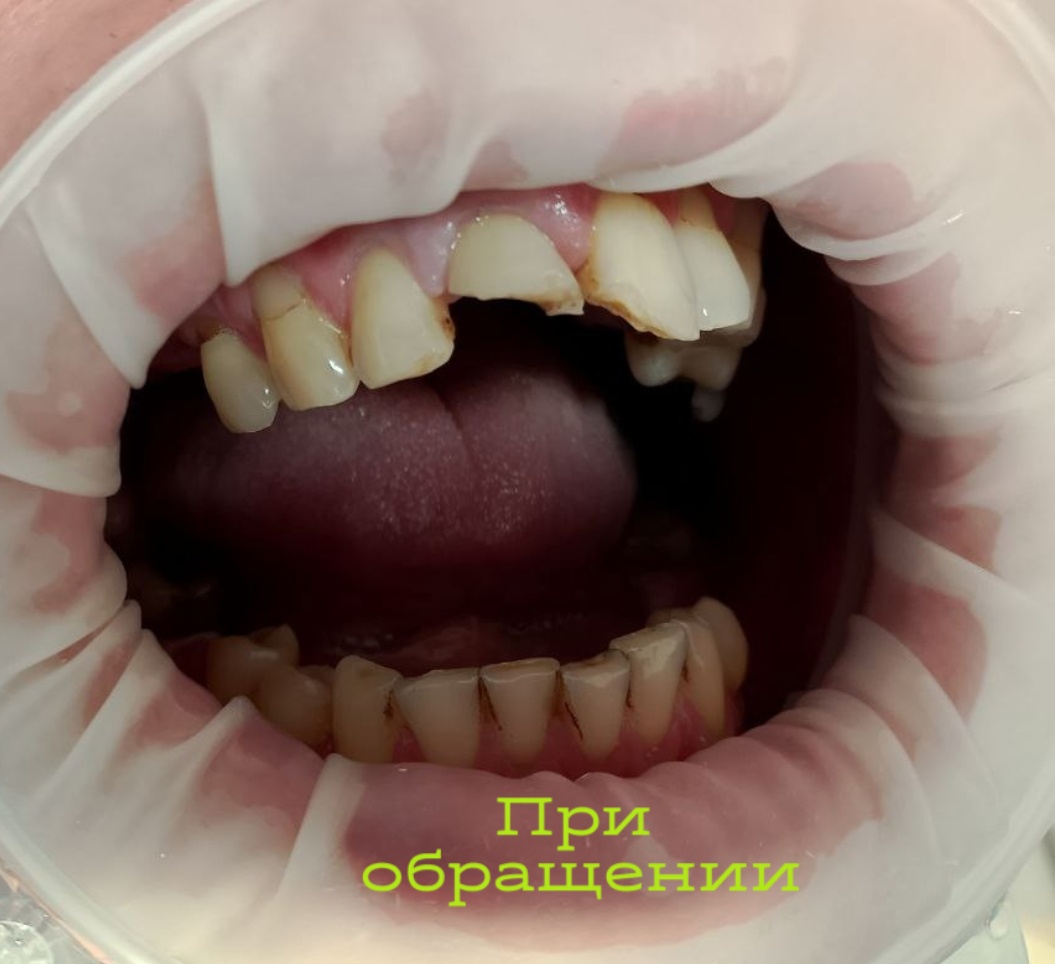 До